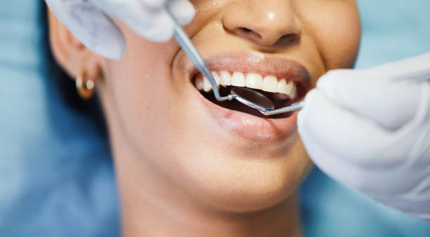Best Emergency Wisdom Teeth Removal in Plainview, TN